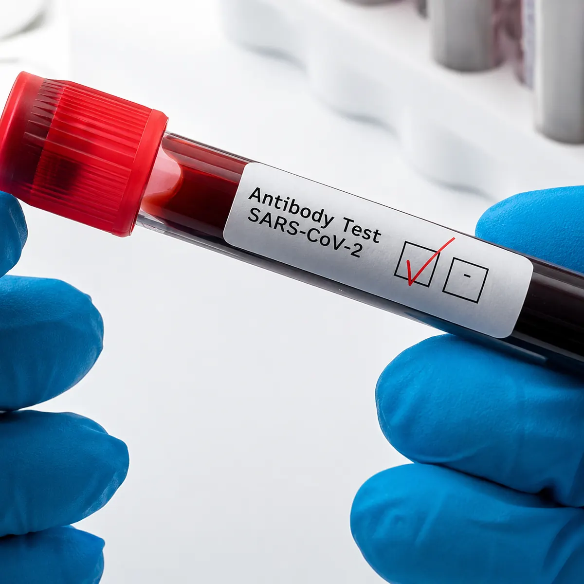 Blood sample being prepared for testing